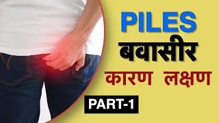 बवासीर के लक्षण क्या है  Dr Vasu  Piles symptoms in Hindi [upl. by Melitta]