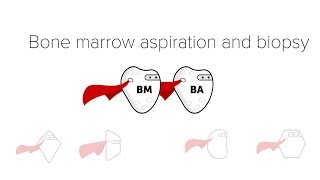 Bone Marrow Biopsy amp Aspiration BMBx [upl. by Hadleigh]