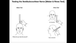 Interpreting the WeberRinne Tests EXPLAINED [upl. by Newo730]