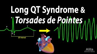 Long QT Syndrome and Torsades de Pointes Animation [upl. by Ardnosal]