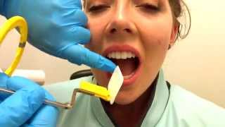 How to Take Periapical Radiographs [upl. by Imelida]