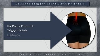 IlioPsoas Pain and Trigger Points [upl. by Cresida]