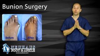 What To Expect After Bunion Surgery [upl. by Aoht]