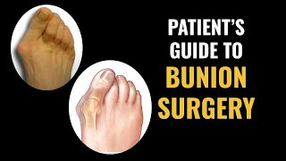 Patients Guide to Bunion Surgery [upl. by Neirual394]