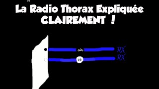 🔴 Dr Astuce  1 LA RADIO THORAX EXPLIQUÉE CLAIREMENT [upl. by Retxab]