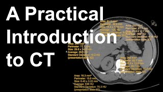 A Practical Introduction to CT [upl. by Zaremski]