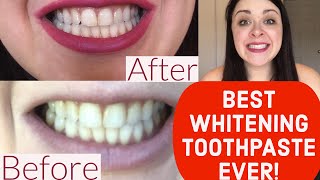 BEST WHITENING TOOTHPASTE EVER REVIEW Crest 3D White Brilliance [upl. by Fenner]