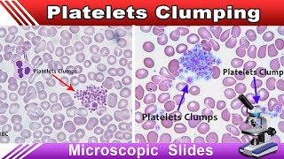 Mean Platelet Volume  What is MPV [upl. by Aicenat]