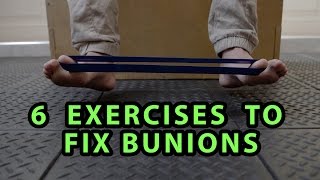 6 Exercises to Fix Bunions [upl. by Sall]