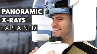 Panoramic Dental XRay Procedure EXPLAINED [upl. by Asek600]