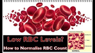 Low RBC Levels – Causes Symptoms Treatment [upl. by Dael299]