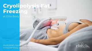 Cryolipolysis Fat Freezing [upl. by Mishaan]