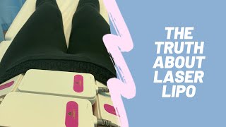 The TRUTH about laser lipo and my experiance [upl. by Ehman]