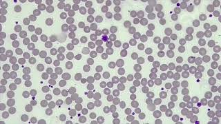 4 Platelet Count Microscope Check [upl. by Hitt]